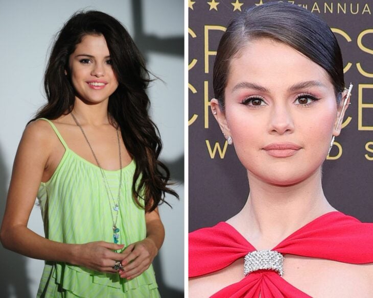 Selena Gomez before and after