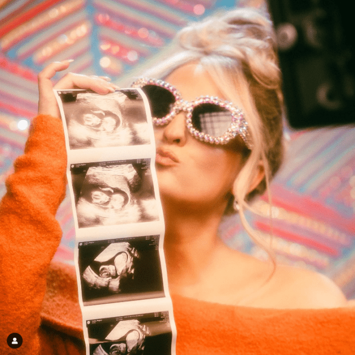 Meghan Trainor is expecting her second child with Daryl Sabara and shows the ultrasound photos