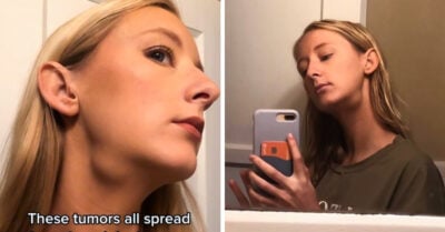 Chica realiza trend de belleza y descubre que tiene cáncer en etapa avanzada
