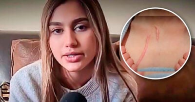 Joven termina con su novio y la agrede 47 veces con una navaja; él esta libre