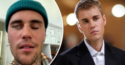 Justin Bieber recupera su sonrisa tras sufrir parálisis facial por extraño síndrome
