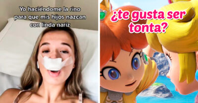 Se hace una rinoplastia para que sus hijos “hereden su nariz” y falló totalmente