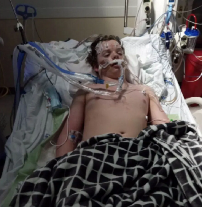 un chico acostado en una cama de hospital y conectado a un respirador