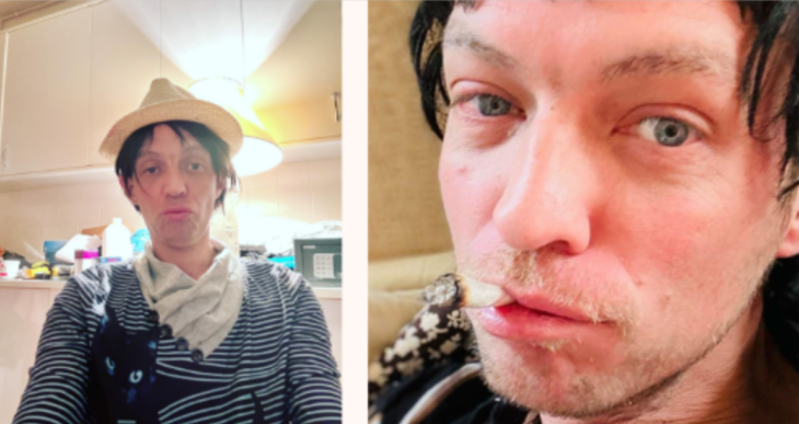 dos imágenes de Camilo Blanes donde luce bastante desmejorado en una se le ve con un sombrero de espantapájaros y en la otra trae un cigarrillo en la boca