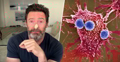 Hugh Jackman podría tener cáncer de piel y pide a sus fans protegerse del sol