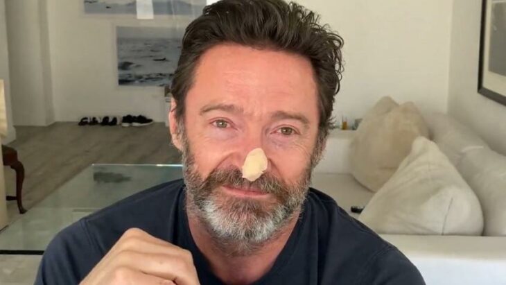 el actor Hugh Jackman luce en su nariz un parche después que le realizaran una biopsia