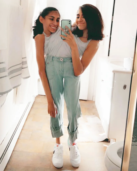 Fotografía de unas hermanas siamesas posando frente al espejo