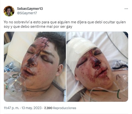 Captura de pantalla de las fotos del hijo de Alfredo Adame con la cara golpeada en un hospital 