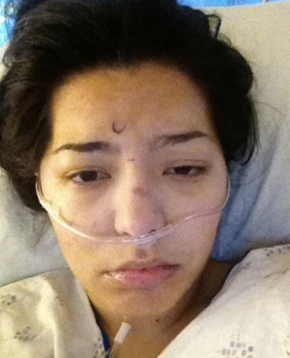 rostro de una chica que esta internada en un hospital lleva una manguera de oxigeno
