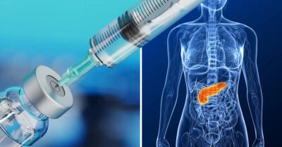 Investigadores logran un primer éxito en la creación de la vacuna contra el cáncer de páncreas