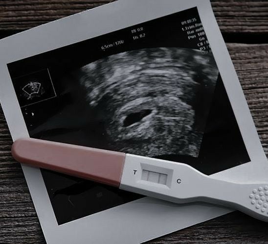 prueba de embarazo y ecografía 