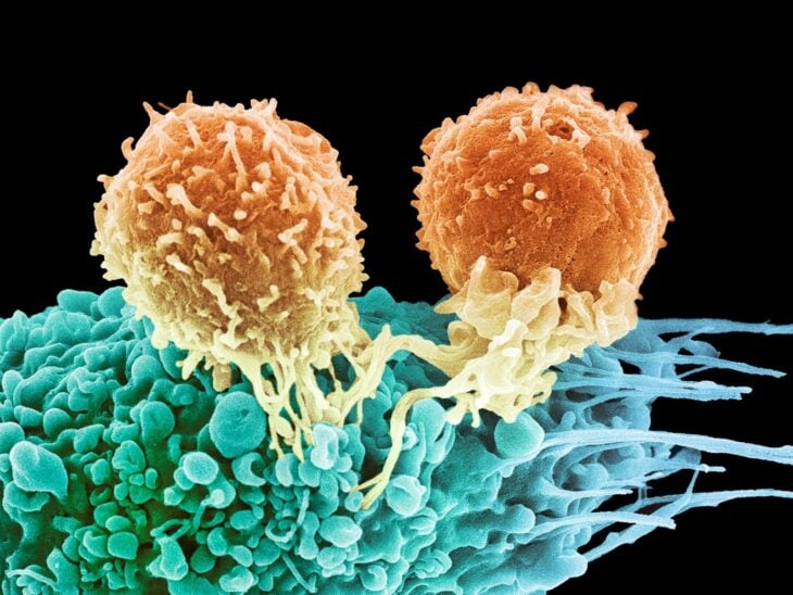 células cancerígenas 