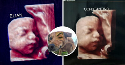 Embarazadas denuncian haber recibido la misma ecografía en una clínica