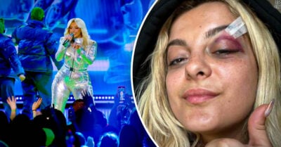 Fan golpea a Bebe Rexha en la cara con un celular y termina en el hospital