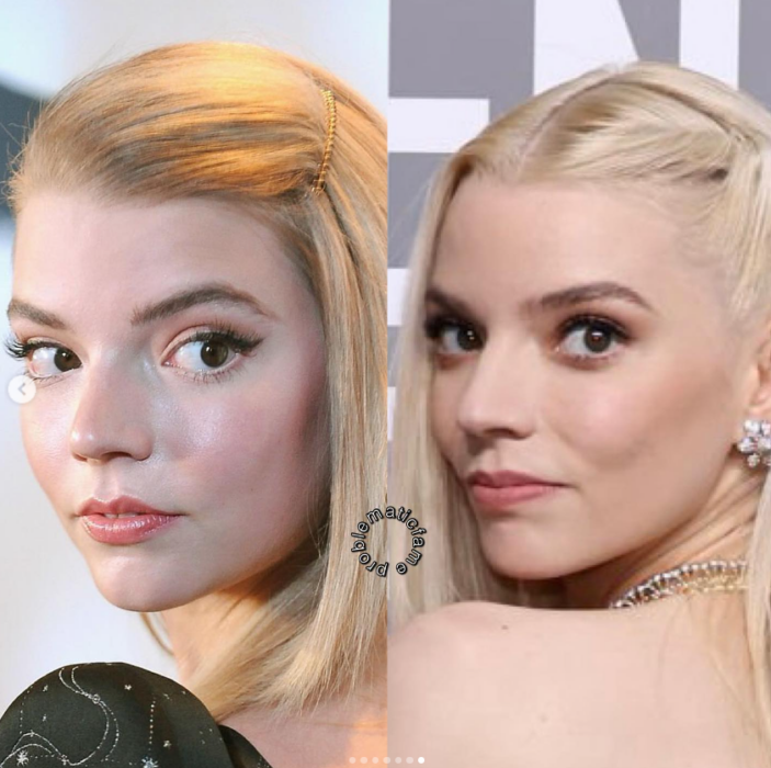 Antes y después: así cambió el rostro de Anya Taylor-Joy tras los retoques tiene una posa de tres cuartos