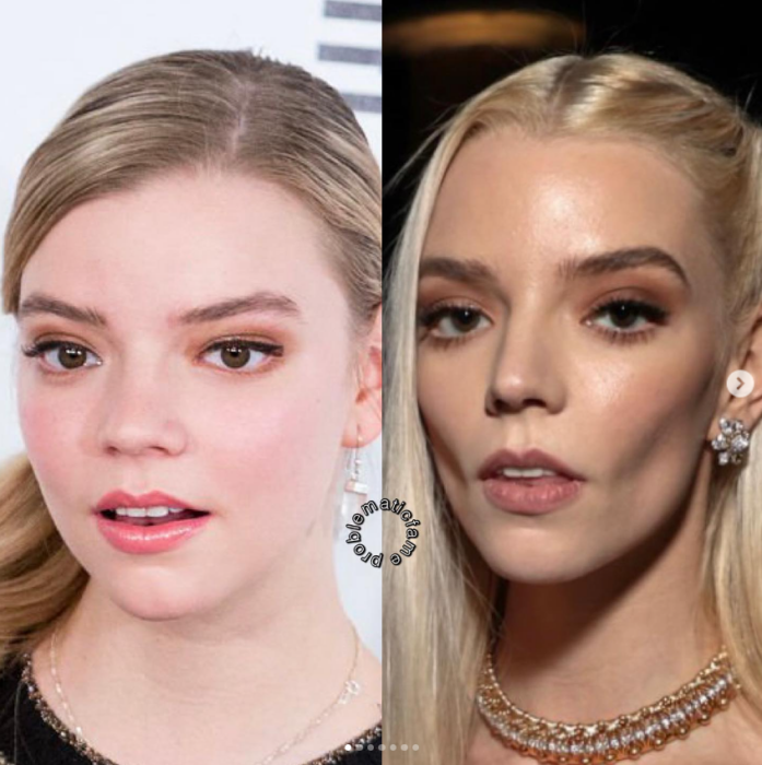 Antes y después: así cambió el rostro de Anya Taylor-Joy tras los retoques es evidente que luce más delgada