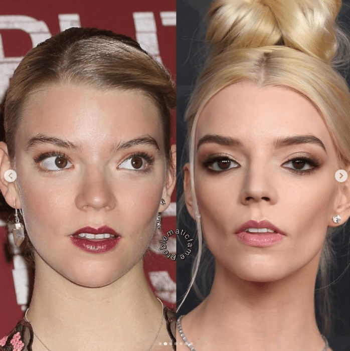 Antes y después: así cambió el rostro de Anya Taylor-Joy tras los retoques se nota tabién un cambio en la forma de maquillarse