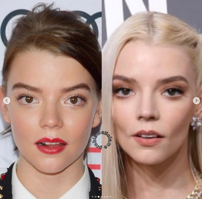 Antes y después: así cambió el rostro de Anya Taylor-Joy tras los retoques luciendo el cabello castaño y después rubio