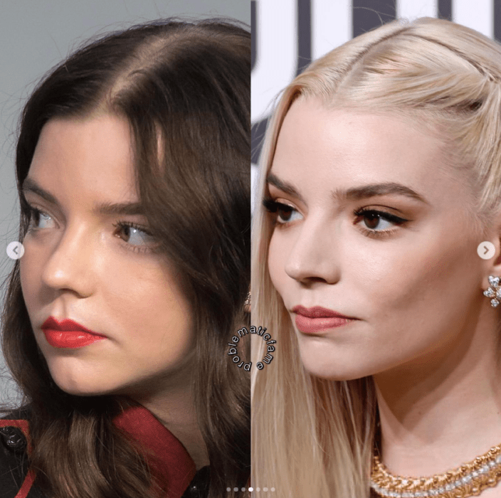 Antes y después: así cambió el rostro de Anya Taylor-Joy tras los retoques el perfil también se le ve distinto