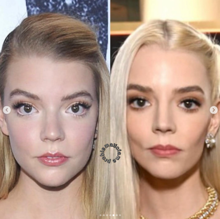 Antes y después: así cambió el rostro de Anya Taylor-Joy tras los retoques en ambas imágenes está mirando de frente