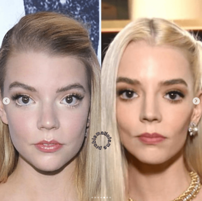 Antes y después: así cambió el rostro de Anya Taylor-Joy tras los retoques en ambas imágenes está mirando de frente