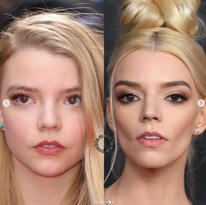 Antes y después: en una imagen luce mucho más pequeña y en la otra ya se ve más refinada, así cambió el rostro de Anya Taylor-Joy tras los retoques