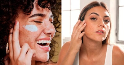 ¿Por qué me salieron manchitas en el rostro y cómo puedo evitarlo?