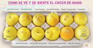 12 limones que pueden ayudarte a detectar el cáncer de mama