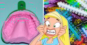 15 Situaciones de tortura que solo una chica que usó brackets entenderá