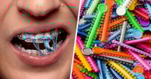 20 Cosas que sólo las chicas que han usado brackets podrán entender